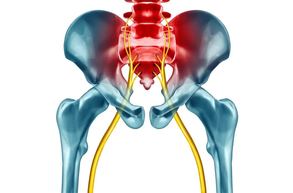 Jakie badania są potrzebne przy rwie kulszowej, aby uniknąć bólu?