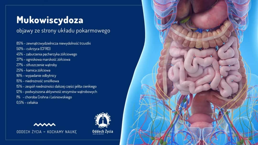 Mukowiscydoza objawy u dorosłego - co musisz wiedzieć, aby pomóc