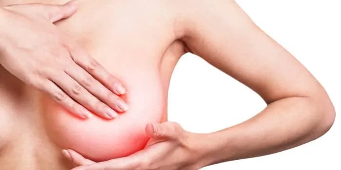 Ropień piersi objawy: Jak rozpoznać i uniknąć powikłań