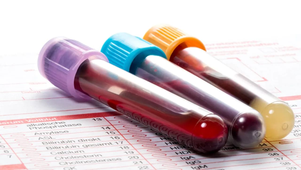 Jak długo są ważne badania morfologii? Sprawdź, zanim będzie za późno