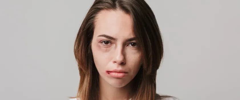 Syndrom sztokholmski skąd nazwa? Odkryj szokującą historię tego terminu