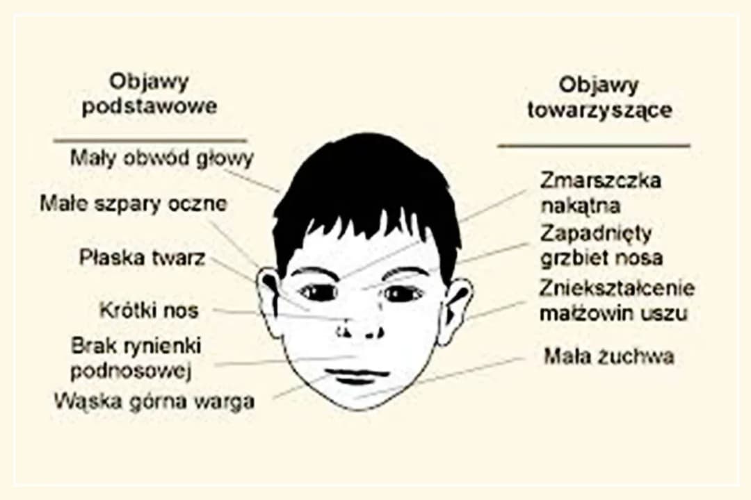Syndrom dziecka alkoholika objawy: Jak rozpoznać skutki dzieciństwa?