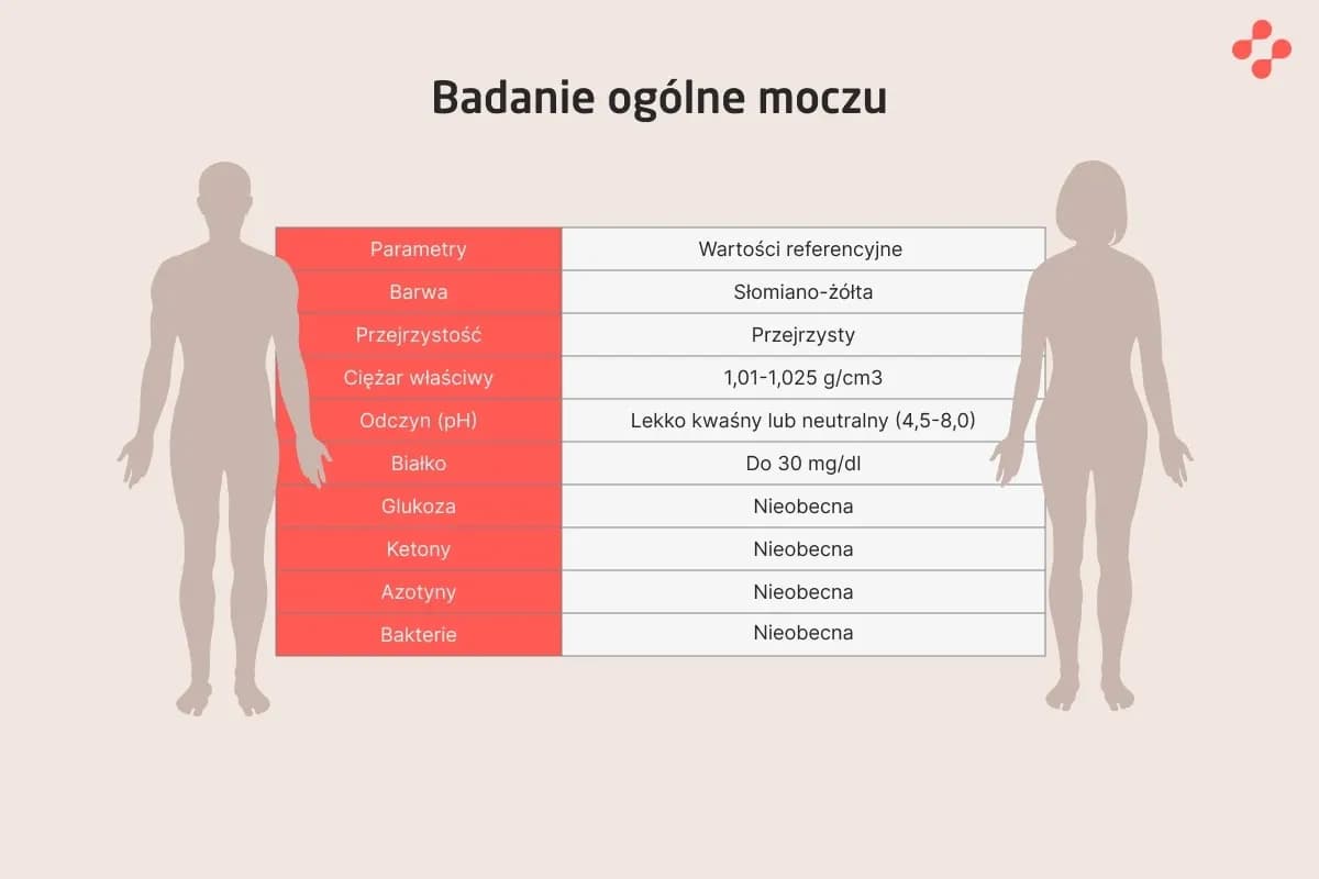 Co może wyjść z badania moczu? Odkryj niepokojące wyniki zdrowotne